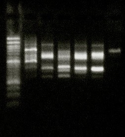 Ergebnis eines genetischen Fingerabdrucks